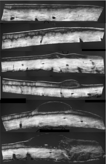 Cartilage strip blister